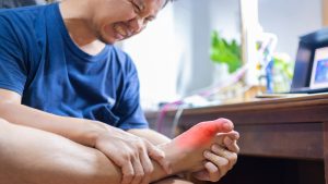 Tự kiểm tra dấu hiệu gout tại nhà trước khi quá muộn